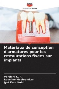 bokomslag Matériaux de conception d'armatures pour les restaurations fixées sur implants