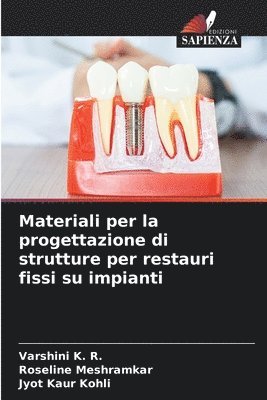 Materiali per la progettazione di strutture per restauri fissi su impianti