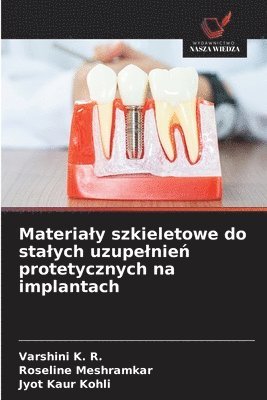 Varshini K R, Roseline Meshramkar, Jyot Kaur Kohli, Varshini K. R., ROSELINE MESHRAMKAR - Materialy szkieletowe do stalych uzupelnień protetycznych na implantach, Häftad