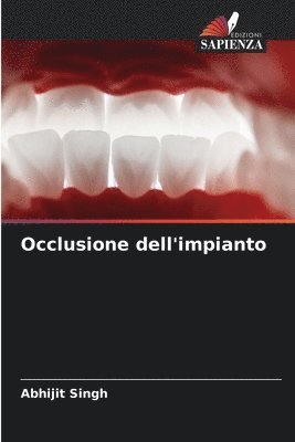 Abhijit Singh - Occlusione dell'impianto, Häftad