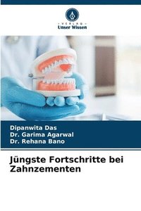 bokomslag Jüngste Fortschritte bei Zahnzementen