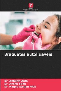 bokomslag Braquetes autoligáveis