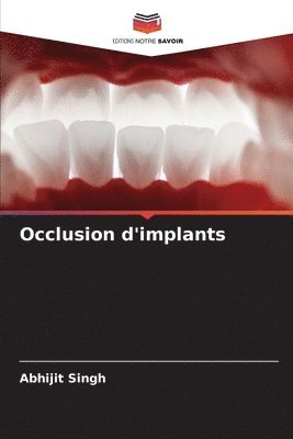 Abhijit Singh - Occlusion d'implants, Häftad