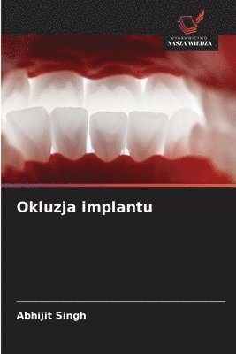 Abhijit Singh - Okluzja implantu, Häftad