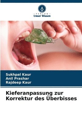 Sukhpal Kaur, Anil Prashar, Rajdeep Kaur - Kieferanpassung zur Korrektur des Überbisses, Häftad