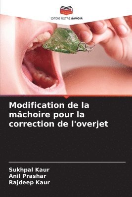 bokomslag Modification de la mâchoire pour la correction de l'overjet