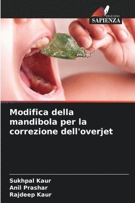 bokomslag Modifica della mandibola per la correzione dell'overjet