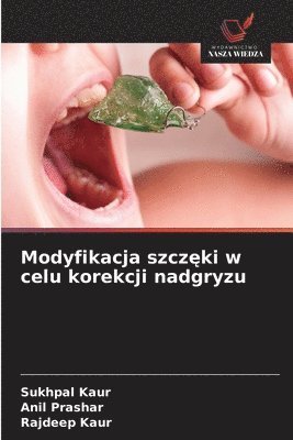 Sukhpal Kaur, Anil Prashar, Rajdeep Kaur - Modyfikacja szczęki w celu korekcji nadgryzu, Häftad