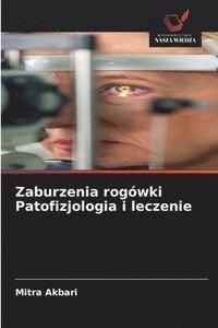 bokomslag Zaburzenia rogówki Patofizjologia i leczenie