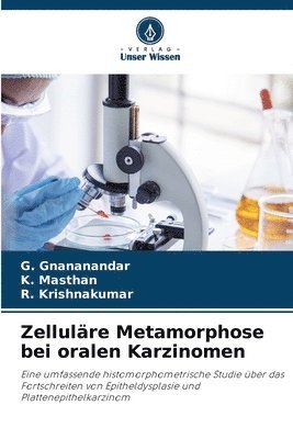 bokomslag Zelluläre Metamorphose bei oralen Karzinomen