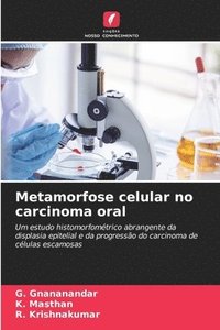 bokomslag Metamorfose celular no carcinoma oral