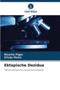 bokomslag Ektopische Dezidua