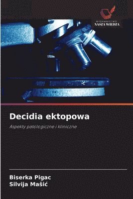 Biserka Pigac, Silvija Masic, Silvija Maic, Silvija Ma¿i¿ - Decidia ektopowa, Häftad