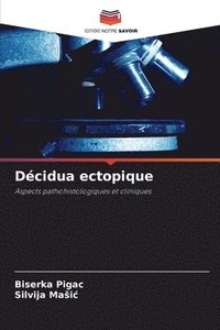 bokomslag Décidua ectopique