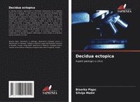 bokomslag Decidua ectopica