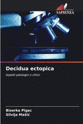 Biserka Pigac, Silvija Masic, Silvija Maic, Silvija Ma¿i¿ - Decidua ectopica, Häftad