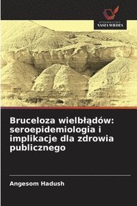 bokomslag Bruceloza wielb¿¿dów: seroepidemiologia i implikacje dla zdrowia publicznego