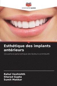 bokomslag Esthétique des implants antérieurs