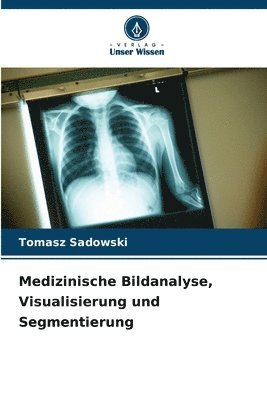 Tomasz Sadowski - Medizinische Bildanalyse, Visualisierung und Segmentierung, Häftad