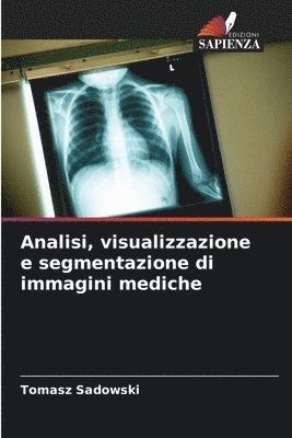 bokomslag Analisi, visualizzazione e segmentazione di immagini mediche