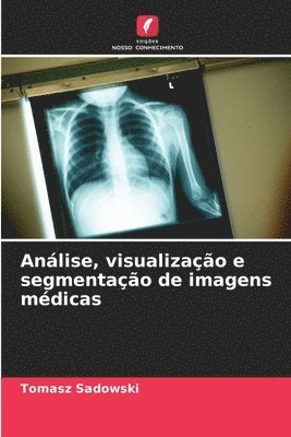 Tomasz Sadowski - Análise, visualização e segmentação de imagens médicas, Häftad