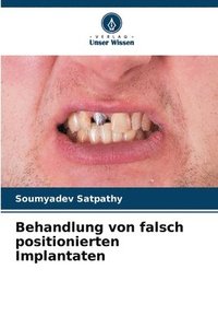bokomslag Behandlung von falsch positionierten Implantaten