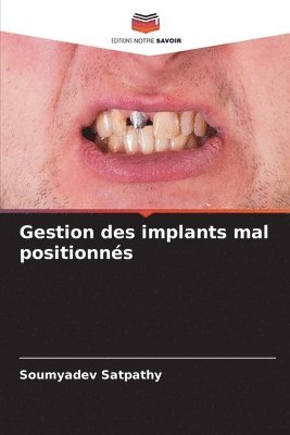 bokomslag Gestion des implants mal positionnés