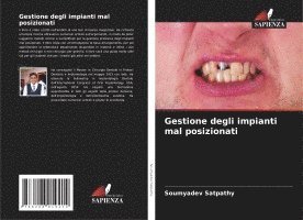 bokomslag Gestione degli impianti mal posizionati
