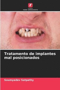 bokomslag Tratamento de implantes mal posicionados