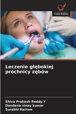 Leczenie glębokiej próchnicy zębów