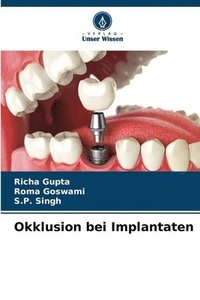 bokomslag Okklusion bei Implantaten