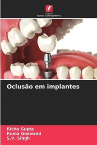 bokomslag Oclusão em implantes