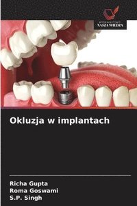 bokomslag Okluzja w implantach