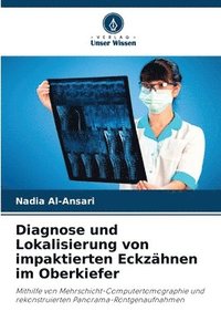 bokomslag Diagnose und Lokalisierung von impaktierten Eckzähnen im Oberkiefer
