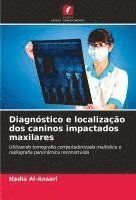 bokomslag Diagnóstico e localização dos caninos impactados maxilares