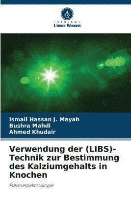 bokomslag Verwendung der (LIBS)-Technik zur Bestimmung des Kalziumgehalts in Knochen