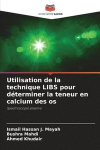 bokomslag Utilisation de la technique LIBS pour déterminer la teneur en calcium des os