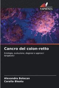bokomslag Cancro del colon-retto