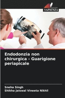 bokomslag Endodonzia non chirurgica - Guarigione periapicale