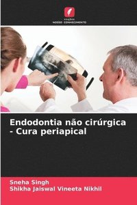 bokomslag Endodontia não cirúrgica - Cura periapical