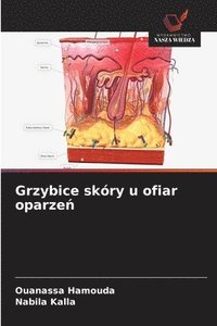 bokomslag Grzybice skóry u ofiar oparze¿