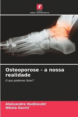 Aleksandra Hadziavdic, Nikola Gavric, Aleksandra Hadiavdic, Aleksandra Had¿iavdi¿, Nikola Gavri¿ - Osteoporose - a nossa realidade, Häftad