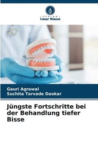 bokomslag Jüngste Fortschritte bei der Behandlung tiefer Bisse