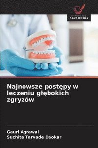 bokomslag Najnowsze post¿py w leczeniu g¿¿bokich zgryzów