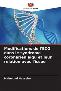 bokomslag Modifications de l'ECG dans le syndrome coronarien aigu et leur relation avec l'issue
