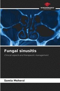 bokomslag Fungal sinusitis