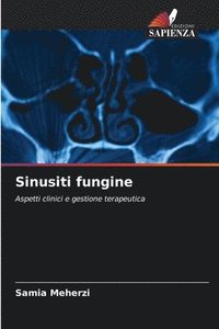 bokomslag Sinusiti fungine
