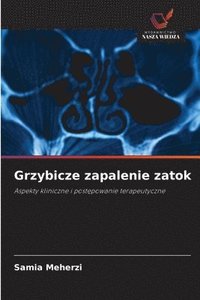 bokomslag Grzybicze zapalenie zatok