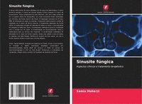 bokomslag Sinusite fúngica