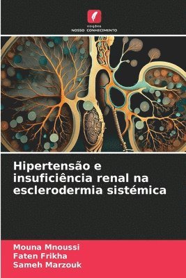 Hipertensão e insuficiência renal na esclerodermia sistémica